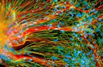stemcell